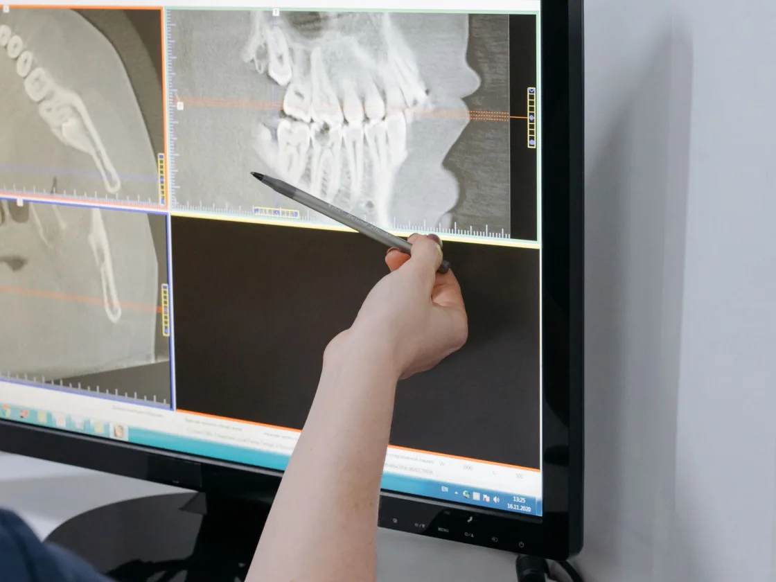 A clinician pointing out detail on an image on the chairside screen