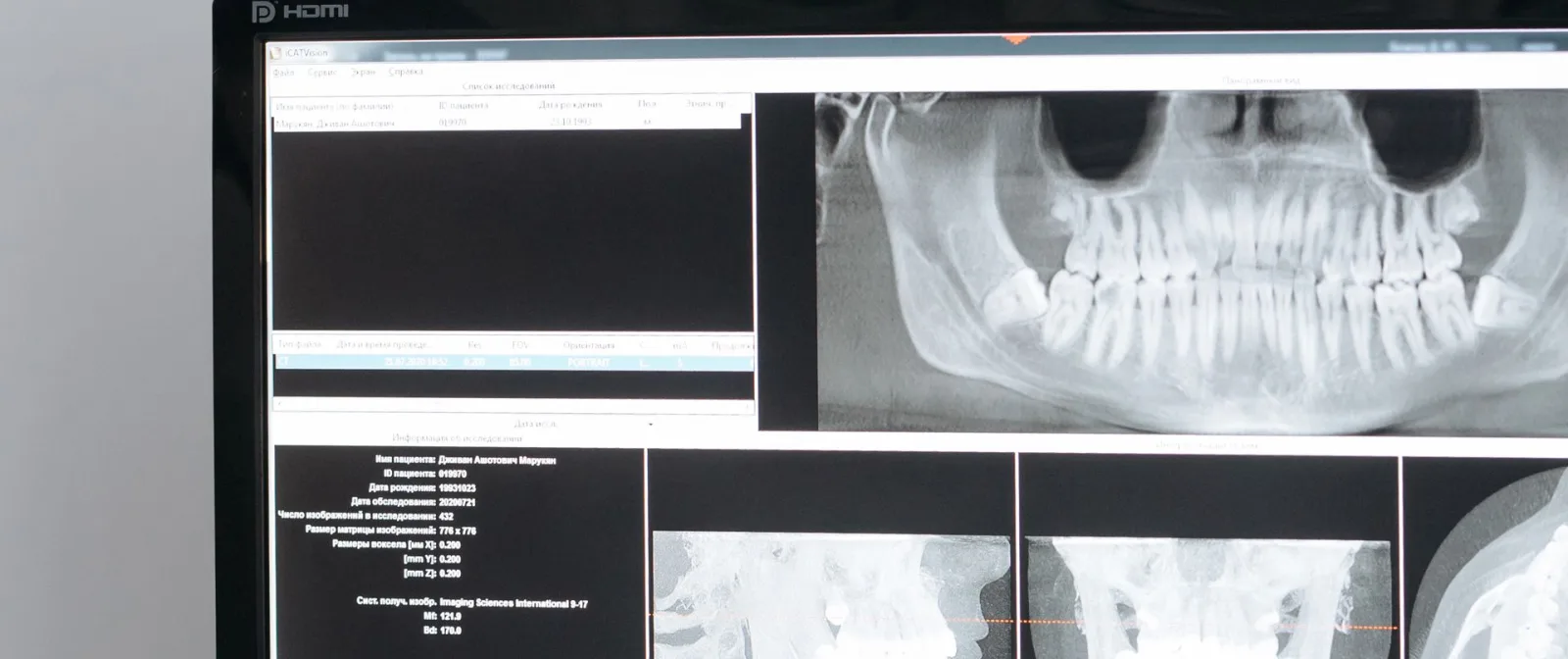 Imaging software open on a practice workstation