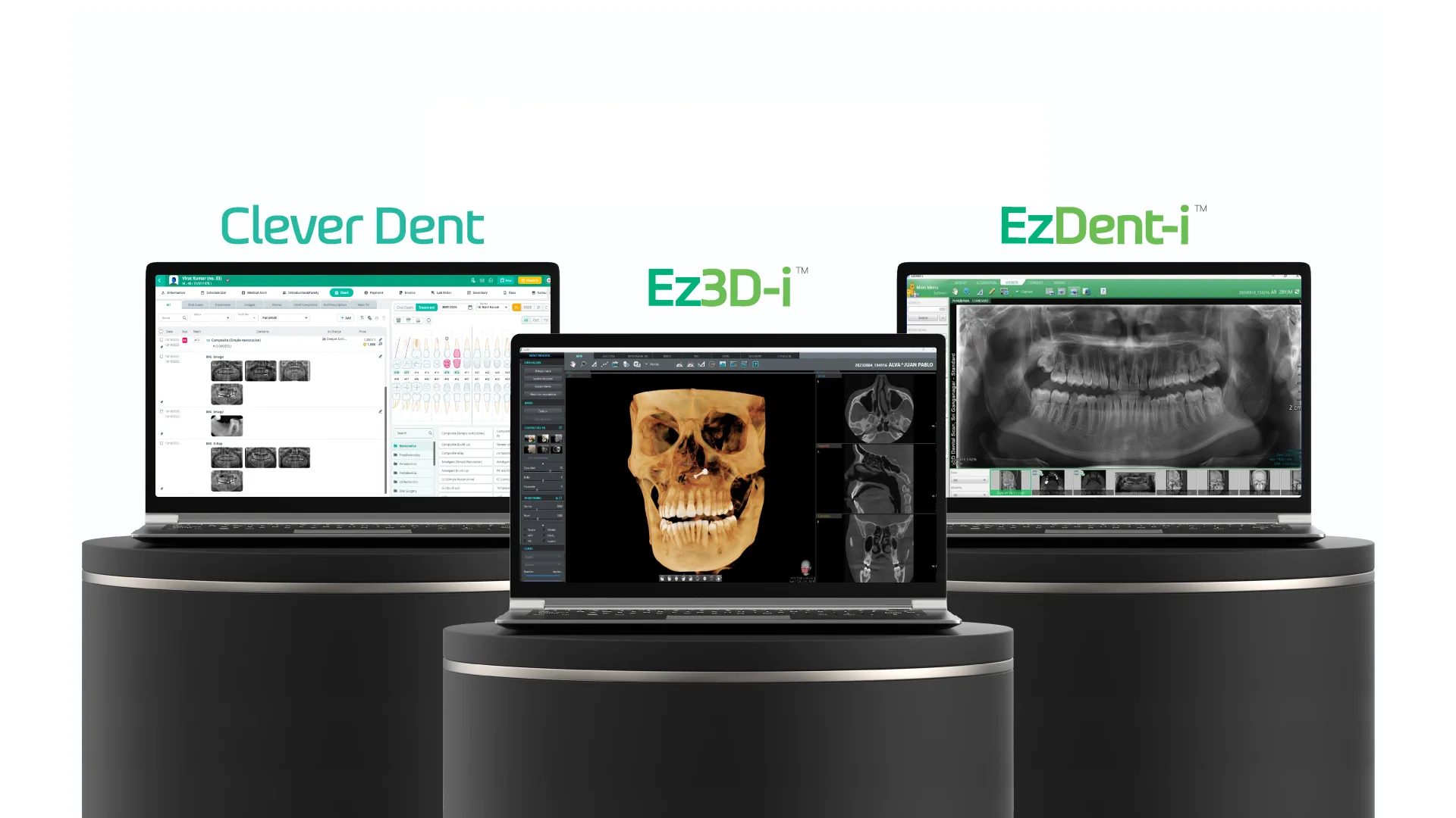 Clever Dent, Ez3D-i and EzDent-i open side by side