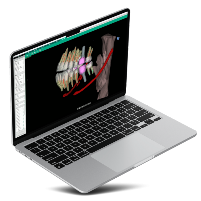 Ez3D-i