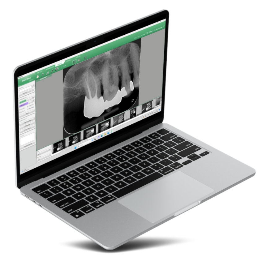 EzDent-i — Imaging & Consultation Software