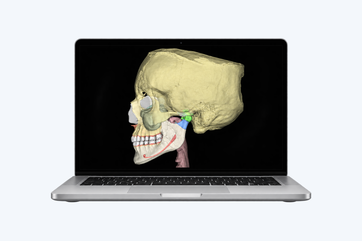 Smart Plus — Extended Arch FOV